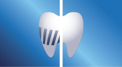 Spolehlivě odstraňuje zubní plak Kartáčková hlavice Philips Soni ProResults - odstraňuje zubní plak