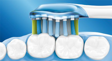 Až 4× větší kontakt s povrchem zubů a dásní Philips Sonicare Flexcare Platinum - adaptivní technologie